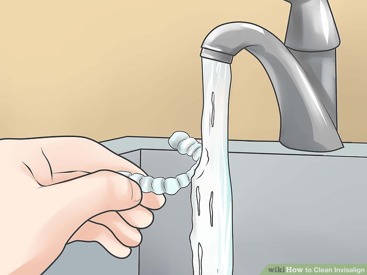 Cleaning Invisalign Braces 1 53005, braces 53005